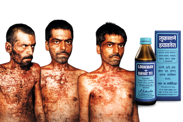 【インド直輸入】ルックマン・エ・ハヤート テル 200ml | 傷・やけど・打撲を癒す万能薬用オイル - Ayurkai